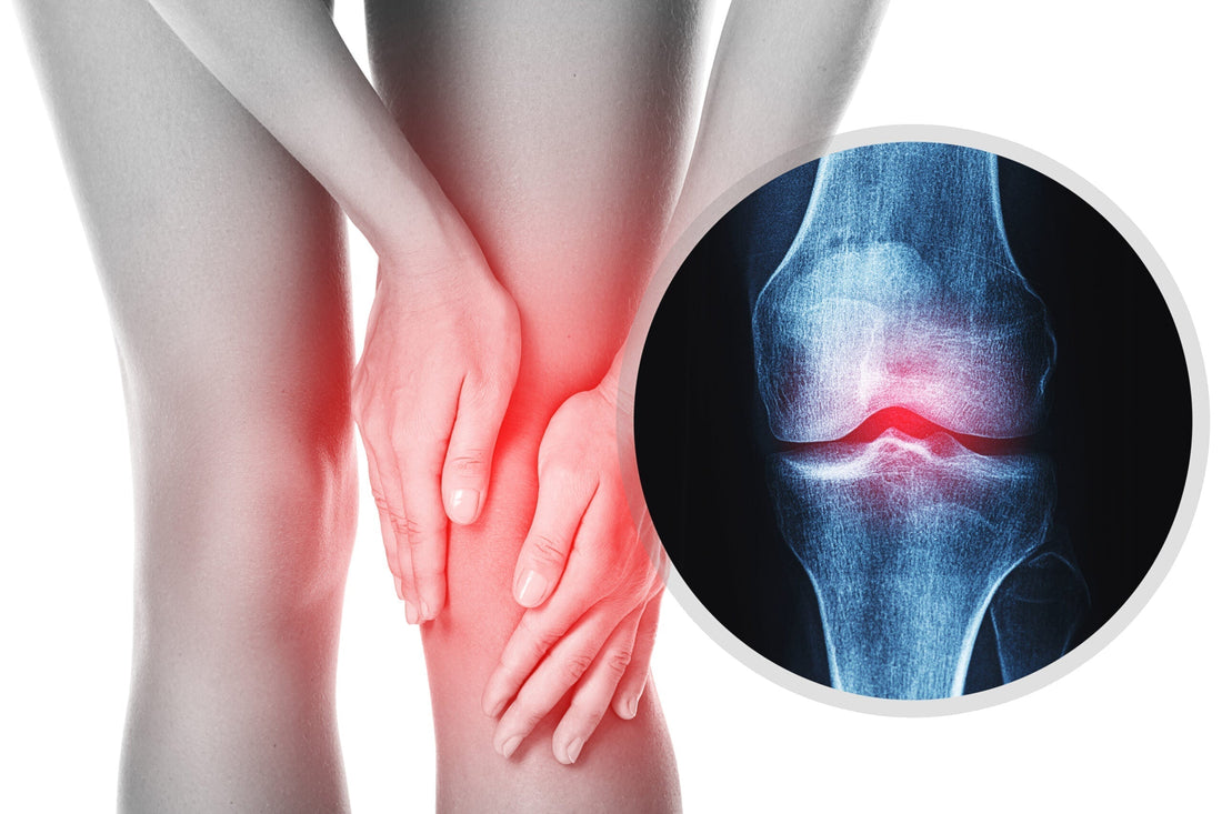Osteoarthritis reduction with Frequency Therapy | QuantumRife