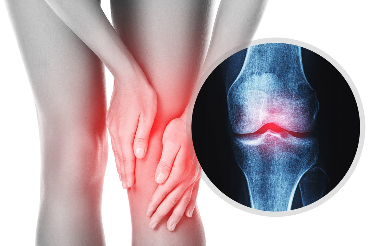 Osteoarthritis reduction with Frequency Therapy | QuantumRife - QuantumRife