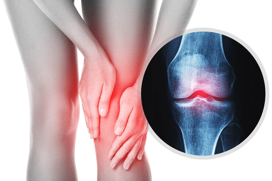 Osteoarthritis reduction with Frequency Therapy | QuantumRife