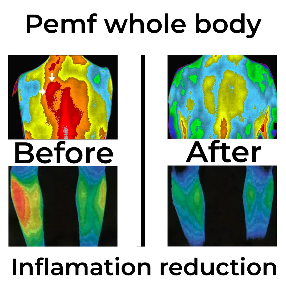 Chronic Inflammation reduction with Frequency Therapy | QuantumRife