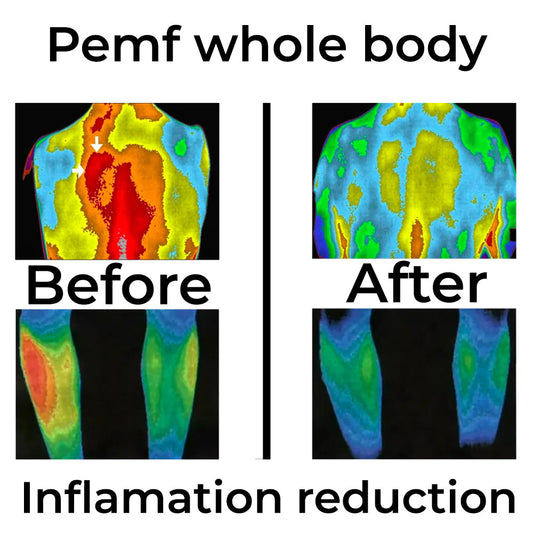 Chronic Inflammation reduction with Frequency Therapy | QuantumRife